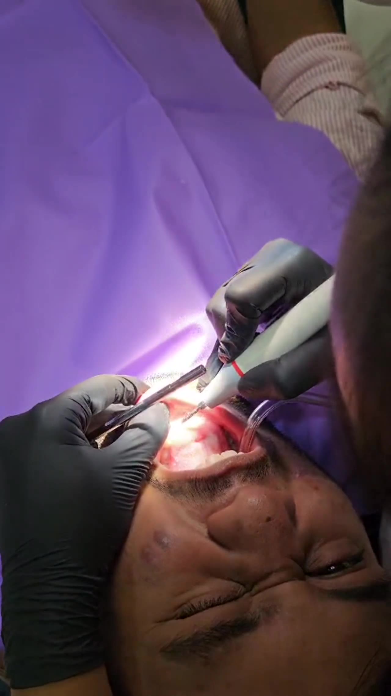 Patient treatment in progress at Smile+ video thumbnail